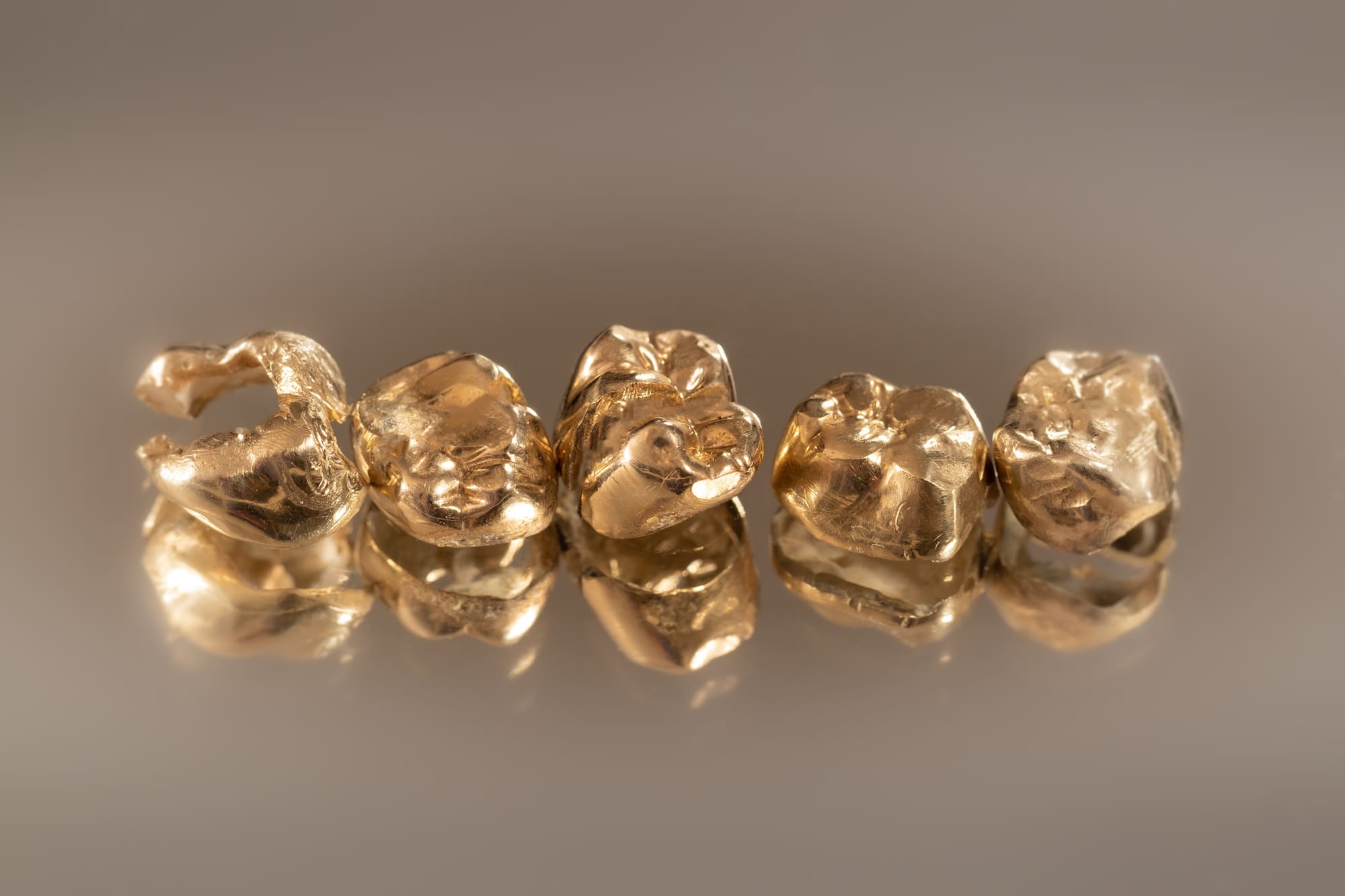 Dents en or illustrant de l’or dentaire pouvant être vendu lors d’un rachat d’or.